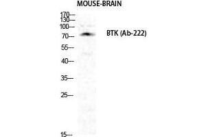 Western Blot (WB) analysis of specific cells using Btk Polyclonal Antibody. (BTK anticorps  (Ser189))