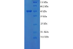 SDS-PAGE (SDS) image for Mitogen-Activated Protein Kinase 3 (MAPK3) (AA 11-379), (partial) protein (His tag) (ABIN5709905)