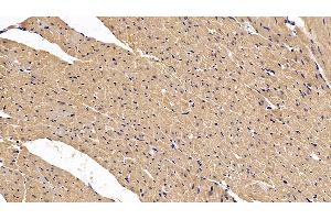 Detection of VEGFA in Rat Cardiac Muscle Tissue using Polyclonal Antibody to Vascular Endothelial Growth Factor A (VEGFA)