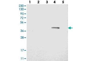 Western blot analysis of Lane 1: RT-4, Lane 2: U-251 MG, Lane 3: Human Plasma, Lane 4: Liver, Lane 5: Tonsil with BTN3A1 polyclonal antibody  at 1:250-1:500 dilution.