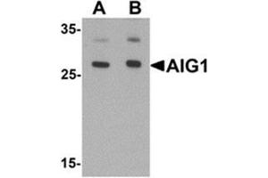 Western blot analysis of AIG1 in human brain tissue lysate with AIG1 antibody at (A) 1 and (B) 2 ug/mL.