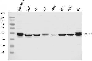 Western blot analysis of Aromatase/Cyp19a1 using anti-Aromatase/Cyp19a1 antibody (ABIN7602417).