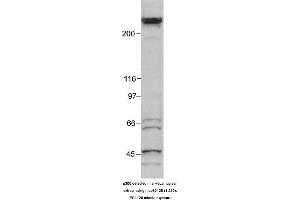 Image no. 1 for anti-E1A Binding Protein P300 (EP300) (AA 1572-2371) antibody (ABIN363280) (p300 anticorps  (AA 1572-2371))