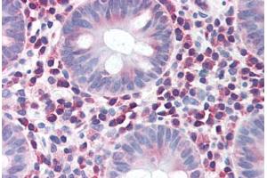 Human Colon (formalin-fixed, paraffin-embedded) stained with IRGM antibody ABIN351455 at 5 ug/ml followed by biotinylated goat anti-rabbit IgG secondary antibody ABIN481713, alkaline phosphatase-streptavidin and chromogen. (IRGM anticorps  (Internal Region))