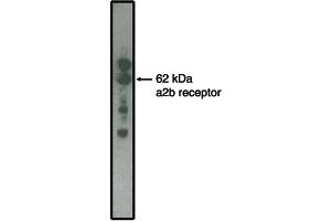 Western blot analysis using alpha2B adrenergic receptor antibody on  MDCK cells transfected to produce alpha2B receptor protein. (RGR anticorps  (Intracellular))