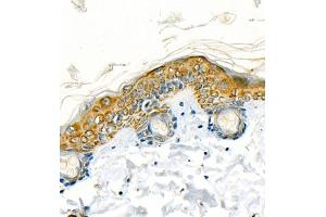 Immunohistochemistry of paraffin embedded rat skin using CK13 (ABIN7074411) at dilution of 1:1200 (400x lens) (Cytokeratin 13 anticorps  (C-Term))