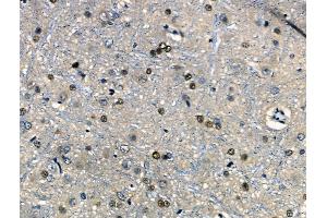 ABIN6262248 and ABIN6266737 at 1/100 staining Rat brain tissue by IHC-P.