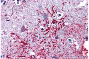 Human Brain, Cortex (formalin-fixed, paraffin-embedded) stained with DHX58 antibody ABIN351452 at 5 ug/ml followed by biotinylated goat anti-rabbit IgG secondary antibody ABIN481713, alkaline phosphatase-streptavidin and chromogen. (DHX58 anticorps  (Internal Region))