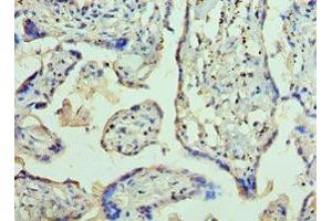 Immunohistochemistry of paraffin-embedded human placenta tissue using ABIN7144363 at dilution of 1:100 (AP2B1 anticorps  (AA 738-937))