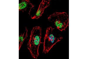 Fluorescent confocal image of Hela cell stained with TBX6 Antibody (Center) (ABIN656001 and ABIN2845380). (T-Box 6 anticorps  (AA 264-293))