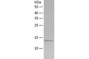 Western Blotting (WB) image for Inhibin, beta C (INHBC) (AA 237-352) protein (His-IF2DI Tag) (ABIN7123425)