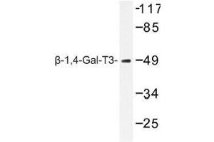 Image no. 1 for anti-UDP-Gal:betaGlcNAc beta 1,4- Galactosyltransferase, Polypeptide 3 (B4GALT3) antibody (ABIN317820) (B4GALT3 anticorps)