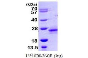 SDS-PAGE (SDS) image for Ras Homolog Family Member D (RHOD) (AA 18-207) protein (His tag) (ABIN6386731)