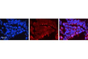 Rabbit Anti-ATF2 Antibody   Formalin Fixed Paraffin Embedded Tissue: Human Ovary Tissue Observed Staining: Cytoplasm Primary Antibody Concentration: 1:100 Other Working Concentrations: N/A Secondary Antibody: Donkey anti-Rabbit-Cy3 Secondary Antibody Concentration: 1:200 Magnification: 20X Exposure Time: 0.
