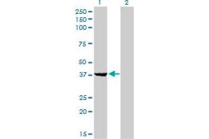 Western Blot analysis of EIF2B2 expression in transfected 293T cell line by EIF2B2 monoclonal antibody (M01), clone 5B12-E10. (EIF2B2 anticorps  (AA 1-351))
