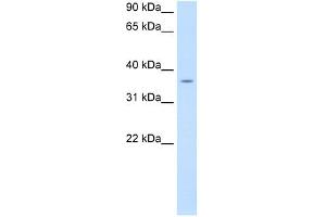 PON1 antibody used at 0. (PON1 anticorps  (C-Term))
