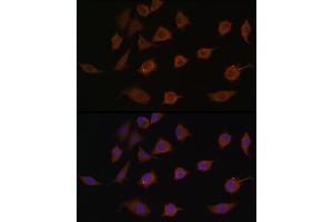Immunofluorescence analysis of L929 cells using LSM1 antibody (ABIN6131868, ABIN6143353, ABIN6143354 and ABIN6216476) at dilution of 1:100.