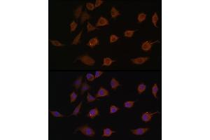 Immunofluorescence analysis of L929 cells using LSM1 antibody (ABIN6131868, ABIN6143353, ABIN6143354 and ABIN6216476) at dilution of 1:100.