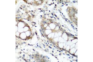 Immunohistochemistry of paraffin-embedded human colon using NAA60 antibody at dilution of 1:200 (40x lens). (NAT15 anticorps)