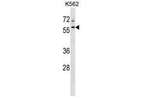 TBL1XR1 Antibody (N-term) western blot analysis in K562 cell line lysates (35µg/lane). (TBL1XR1 anticorps  (N-Term))