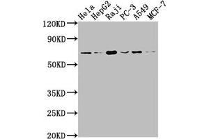 Western Blot Positive WB detected in: Hela whole cell lysate, HepG2 whole cell lysate, Raji whole cell lysate, PC-3 whole cell lysate, A549 whole cell lysate, MCF-7 whole cell lysate All lanes: ALAS1 antibody at 1:1500 Secondary Goat polyclonal to rabbit IgG at 1/50000 dilution Predicted band size: 71, 13 kDa Observed band size: 71 kDa (Recombinant ALAS1 anticorps)