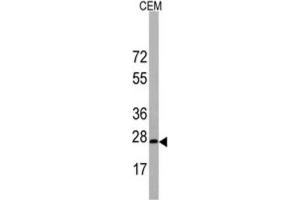 Western Blotting (WB) image for anti-BARX Homeobox 1 (BARX1) antibody (ABIN3003108) (BARX1 anticorps)