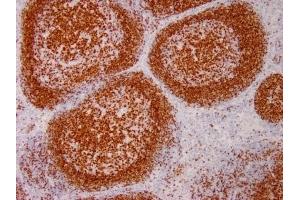 Formalin-fixed, paraffin-embedded human Tonsil stained with PAX5 Mouse Monoclonal Antibody (PAX5/3735).