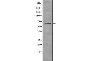 Western blot analysis of CTPS using K562 whole cell lysates