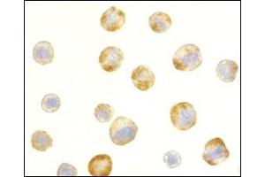 Immunocytochemistry of RAIDD in HeLa cells with RAIDD antibody at 5 μg/ml.