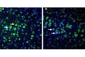 Expression of NETO1 in rat and mouse cortex.