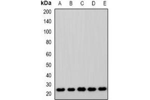 Western blot analysis of ASF1A expression in Jurkat (A), A549 (B), MCF7 (C), mouse lung (D), rat lung (E) whole cell lysates. (ASF1A anticorps)