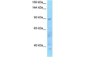 WB Suggested Anti-SECISBP2 Antibody Titration: 1. (SECISBP2 anticorps  (N-Term))