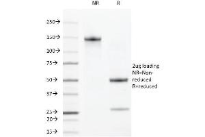 SDS-PAGE Analysis Purified VEGFR2 Rat Monoclonal Antibody (DC101). (VEGFR2/CD309 anticorps)