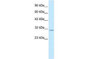 WB Suggested Anti-KCNIP4 Antibody Titration:  0. (KCNIP4 anticorps  (N-Term))