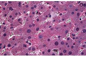 Human Liver: Formalin-Fixed, Paraffin-Embedded (FFPE)