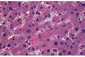 Human Liver: Formalin-Fixed, Paraffin-Embedded (FFPE) (ORM1 anticorps  (AA 18-202))