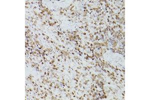 Immunohistochemistry of paraffin-embedded rat spleen using G antibody (ABIN6133721, ABIN6140975, ABIN6140976 and ABIN6217864) at dilution of 1:150 (40x lens).