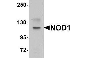 Western blot analysis of NOD1 in EL4 cell lysate with NOD1 antibody at 1 µg/mL. (NOD1 anticorps  (C-Term))