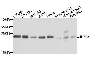 Western blot analysis of extracts of various cell lines, using IL36A antibody. (IL36A/IL1F6 anticorps  (AA 1-158))