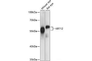 Western blot analysis of extracts of various cell lines using KRT12 Polyclonal Antibody at dilution of 1:1000. (KRT12 anticorps)