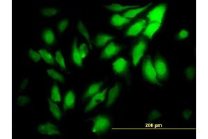 Immunofluorescence of monoclonal antibody to WDR5 on HeLa cell. (WDR5 anticorps  (AA 16-120))
