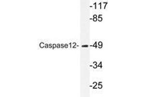 Western blot analysis of Caspase12 antibody in extracts from HUVEC cells. (Caspase 12 anticorps)
