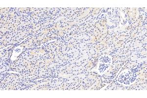 anti-Glutathione S-Transferase mu 2 (Muscle) (GSTM2) (AA 3-218) antibody