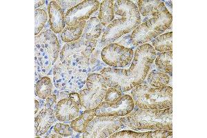 Immunohistochemistry of paraffin-embedded mouse kidney using CDH16 antibody.