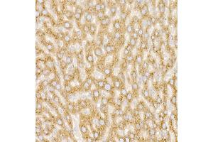 Immunohistochemistry of paraffin-embedded Rat liver using GM130 antibody (ABIN6129789, ABIN6141264, ABIN6141265 and ABIN6220979) at dilution of 1:25 (40x lens).