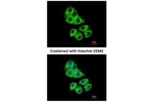 ICC/IF Image Immunofluorescence analysis of methanol-fixed Hep G2, using Coronin 1A, antibody at 1:500 dilution.