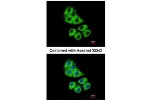 ICC/IF Image Immunofluorescence analysis of methanol-fixed Hep G2, using Coronin 1A, antibody at 1:500 dilution. (Coronin 1a anticorps  (C-Term))