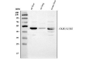 Western blot analysis of LOX using anti-LOX antibody (ABIN3042506).