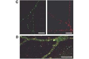 (C) Surface distribution of anti-GluR1-4R (green) and anti-GluR1-4GP (red) immunoreactivity on living hippocampal neurons in culture (14 DIV).
