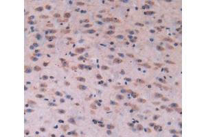 Used in DAB staining on fromalin fixed paraffin- embedded brain tissue